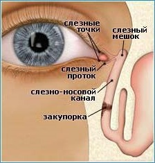 фото-схема болезни