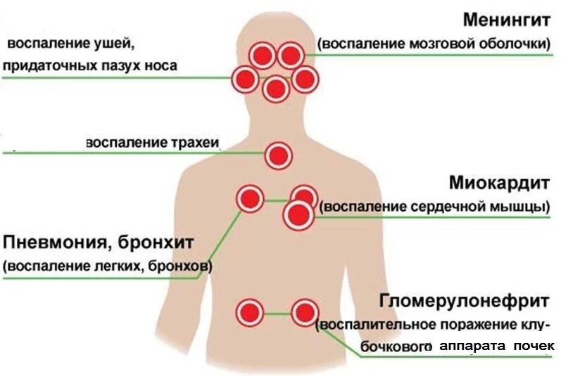 Противогриппозная вакцина - кому, когда и зачем