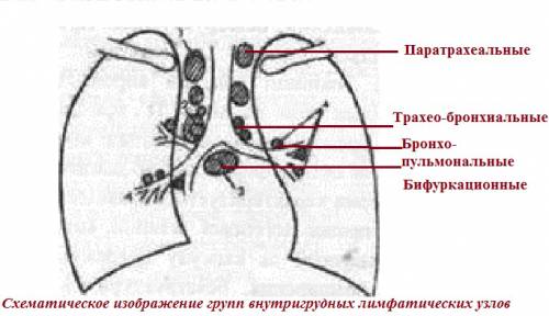 Изображение групп внутригрудных лимфоузлов