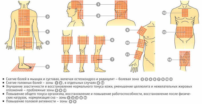 Зоны воздействия Зоны воздействия