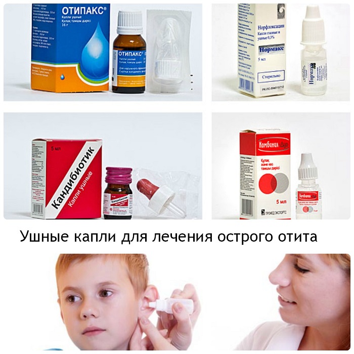 Ушные капли для острого среднего отита Ушные капли для острого среднего отита у ребенка