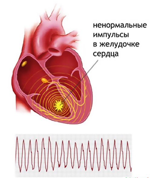 Импульсы в сердце Сердце