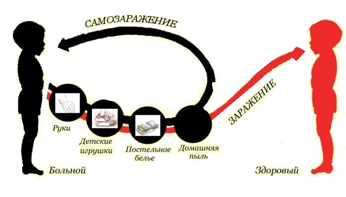 Пути заражения энтеробиозом Схема появления энтеробиоза