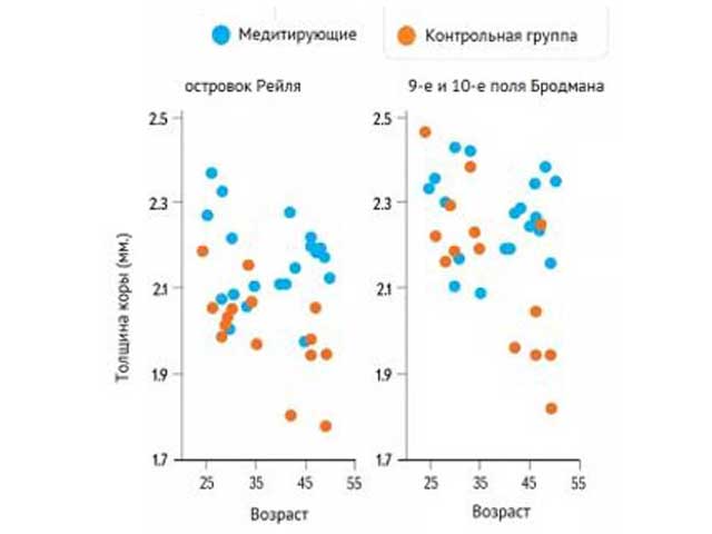 Плотность серого вещества до и после медитации Исследования влияния медитации на мозг человека