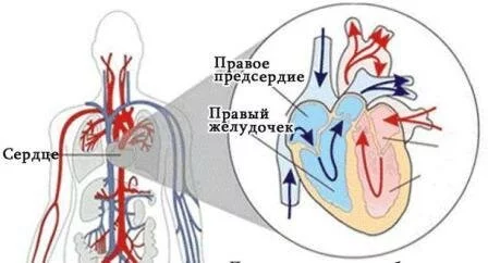 Течение заболевания Клиническая картина митрального стеноза
