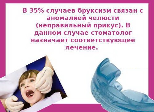 Причины бруксизма у детей Причины скрежетания зубами