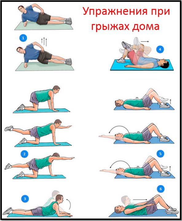 Лфк при грыже поясничного отдела позвоночника ЛФК при поясничной грыже позвоночника – упражнения
