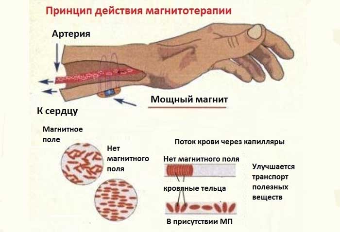 Есть ли польза от магнитотерапии Магнитотерапия: показания к применению