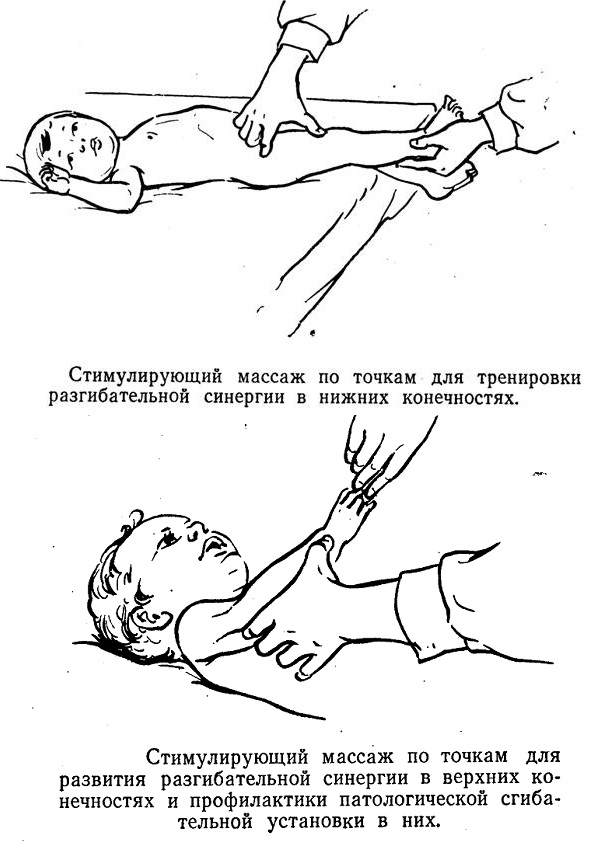 Работа с нижними и верхними конечностями при ДЦП