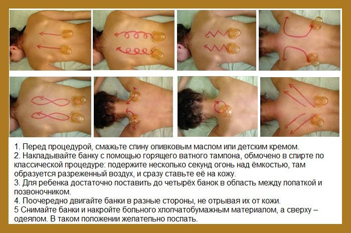 Баночный массаж ребенку