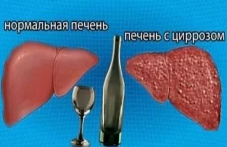 Причины отклонений печени Размеры печени человека