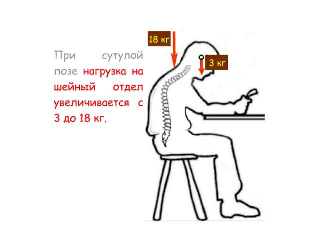 Нагрузка на шейный отдел при сутулой позе