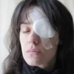 Неотложная помощь при ожоге глаз щелочью Неотложная помощь при ожоге глаз щелочью