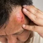 Первая помощь при ушибе головы Первая помощь при ушибе головы
