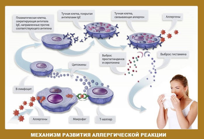 Механизм развития аллергической реакции у детей Механизм развития аллергической реакции ведущей к бронхоспазму