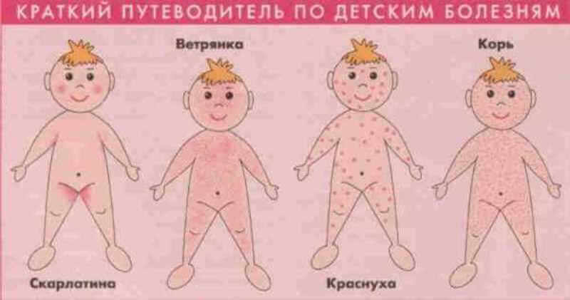 Причины сыпи у детей