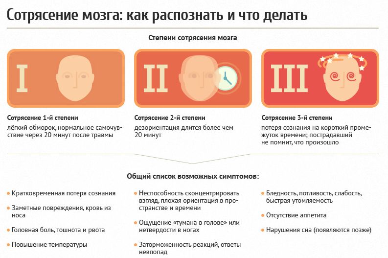 Стадии и симптомы сотрясения головы Стадии и симптомы сотрясения головы у ребенка