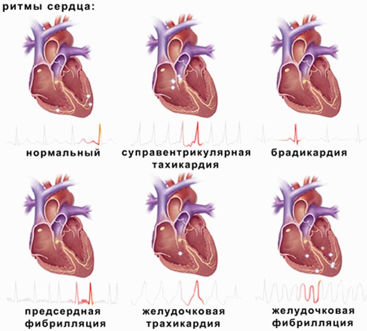 Виды ритмов сердца ритмы сердца